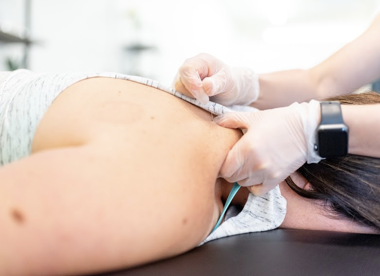 dry needling fixxed haverhill