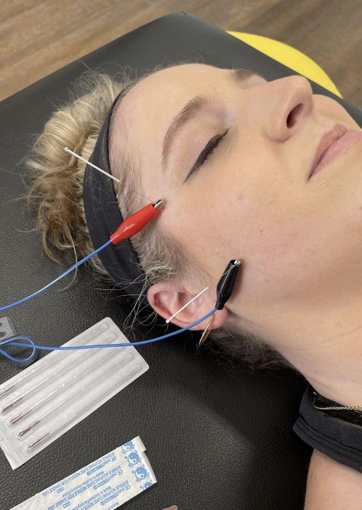 TMJ Treatment
